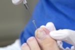 APMA Partners with CAC Representatives and Dermatology to Challenge Proposed Surgical Treatment of Nails Policy