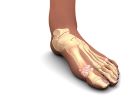 illustration of gout in toe joint